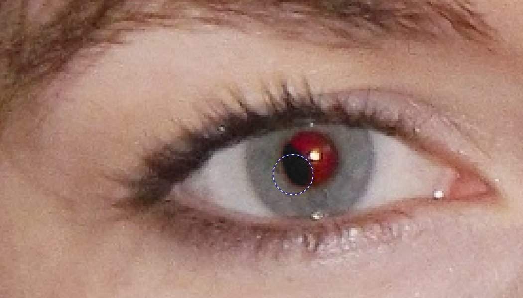 Jak se rychle zbavit červených oči?